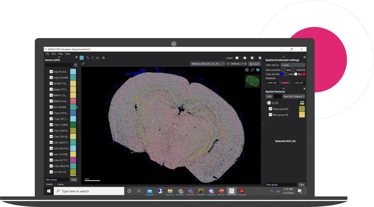 Developing new tools to accelerate spatial genomics and drug discovery - Vimarsana News