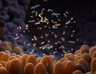 Synthetic gut lining developed for microbiome research