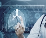AI could improve accuracy and speed of lupus nephritis diagnosis