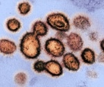 Study reveals high prevalence of persistent COVID-19 infections in general population