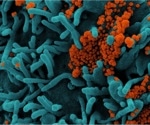 Researchers identify a protein that facilitates spread of SARS-CoV-2 virus through cells