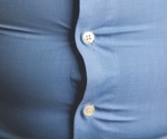 Maternal obesity and birth defects