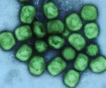 New study offers rare glimpse of how the smallpox virus attacks its victims