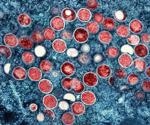 Epidemiology and the public health response of monkeypox