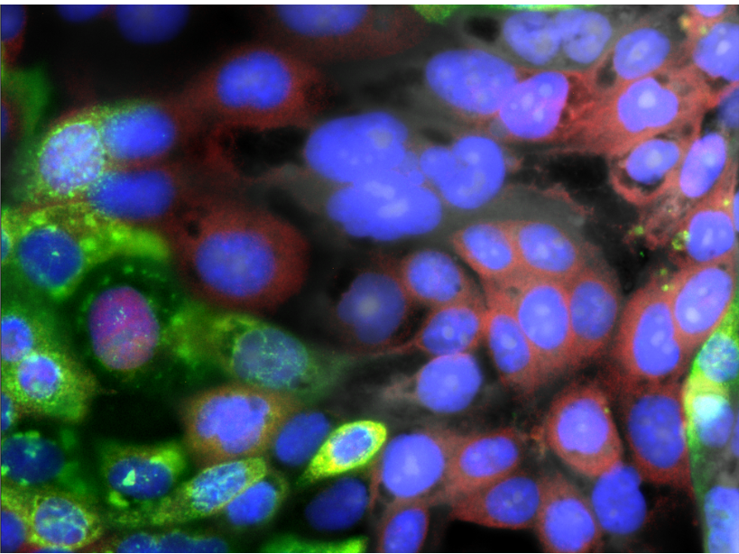 Human airway cells; with SARS-CoV-2 in green, innate immune response in red, and nucleus in blue