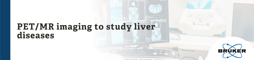 PET/MR imaging to study liver diseases