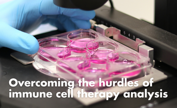 Overcoming the hurdles of immune cell therapy analysis