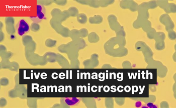 Live cell imaging with Raman microscopy