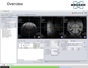 Improve Your Imaging Results with ParaVision 6